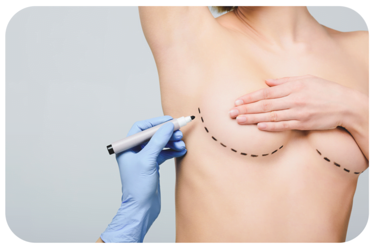 quest-ce-que-le-lipofilling-mammaire