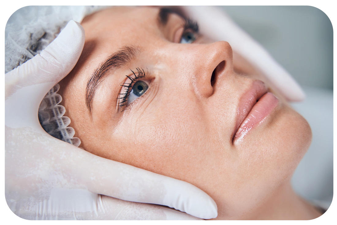 lipofiling-visage-de-quoi-sagit-il