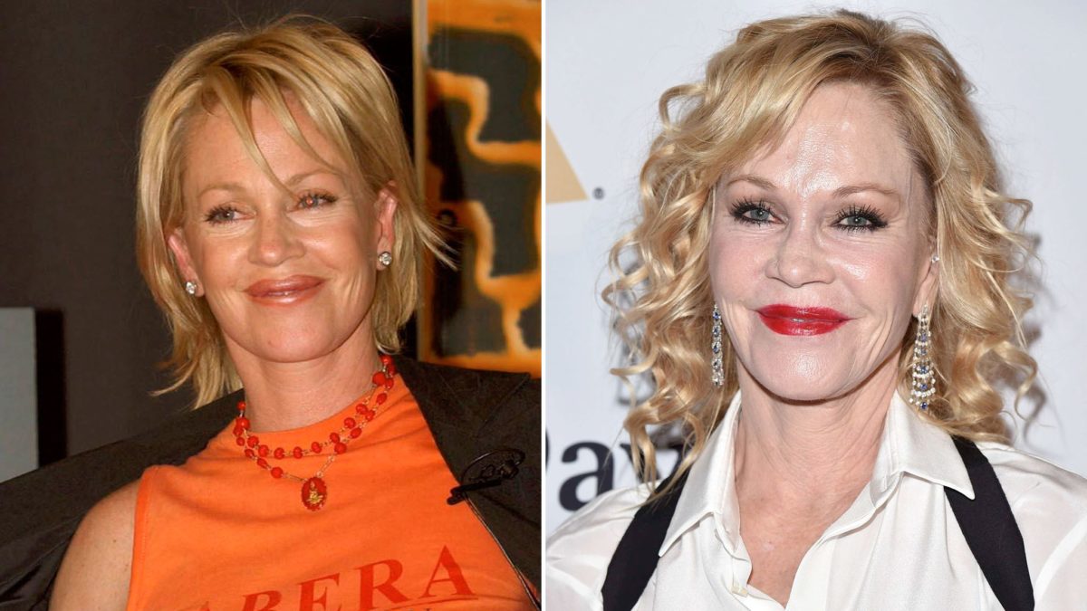 photos-avant-apres-ces-stars-qui-ont-vraiment-abuse-de-la-chirurgie-esthetique-1200x675.jpg