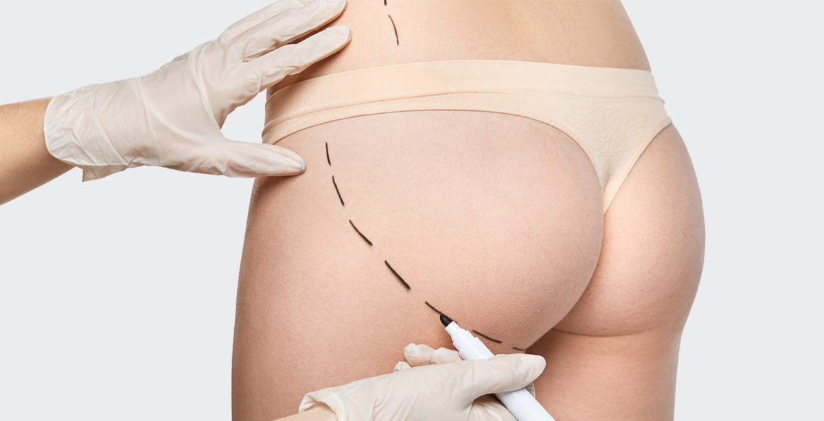 chirurgie_silhouette2-1200x614.jpg