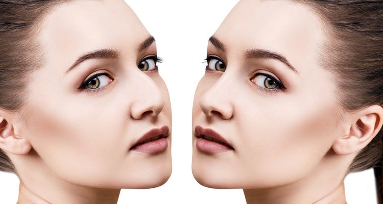 rhinoplastie-tunisie.jpg