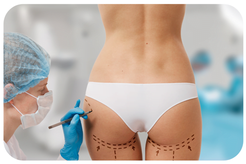 lipofilling-fesses tunisie