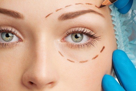 Blepharoplasty tunisia