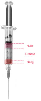 lipofilling-fesses-injection