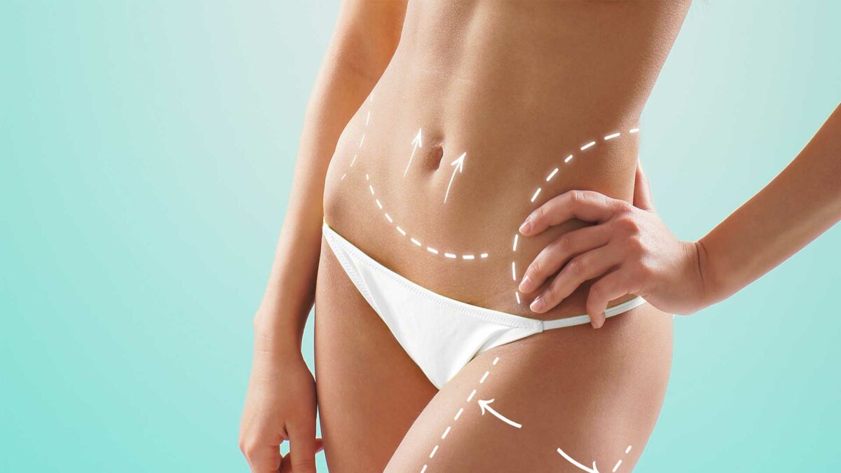 Est-Ce Que La Liposuccion Fait Perdre Du Poids ?