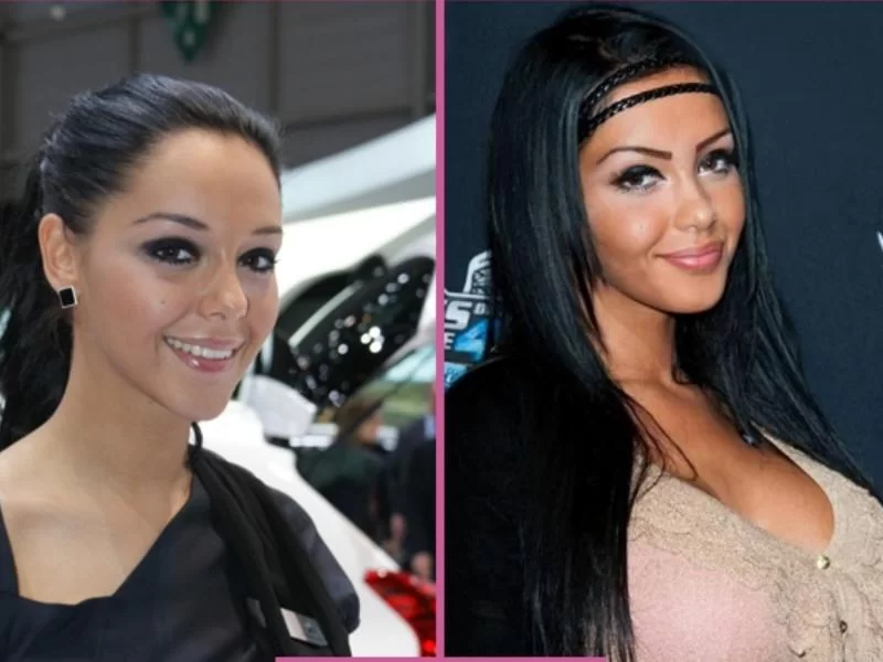 Nabilla-chirurgie-esthetique