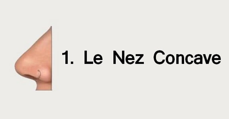 nez-concave