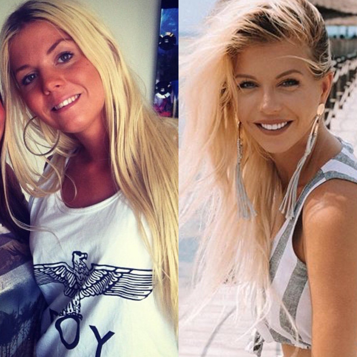 Jessica Thivenin Sans chirurgie / Jessica Thivenin après chirurgie esthétique