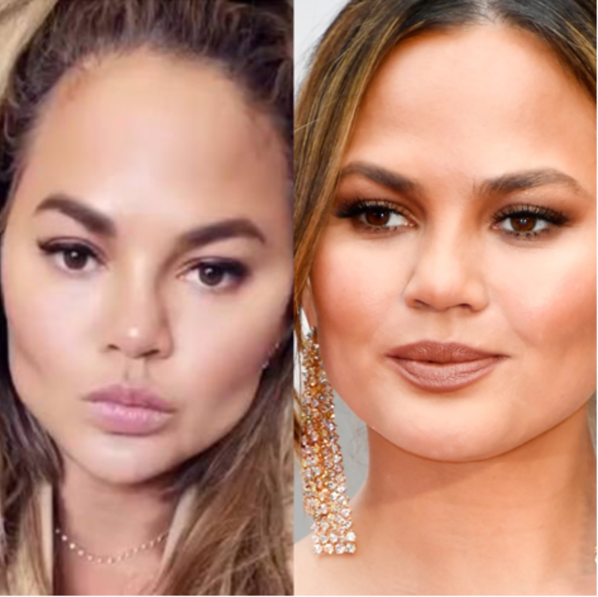 Chrissy Teigen : la star adepte du Buccal Fat Removal