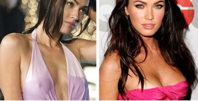 Megan Fox avant et après une augmentation mammaire