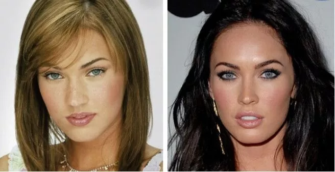 Megan Fox avant et après la chirurgie esthétique du nez (rhinoplastie)