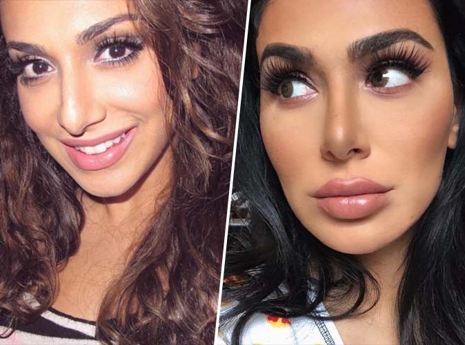 Huda Kattan, avant après la Rhinoplastie 