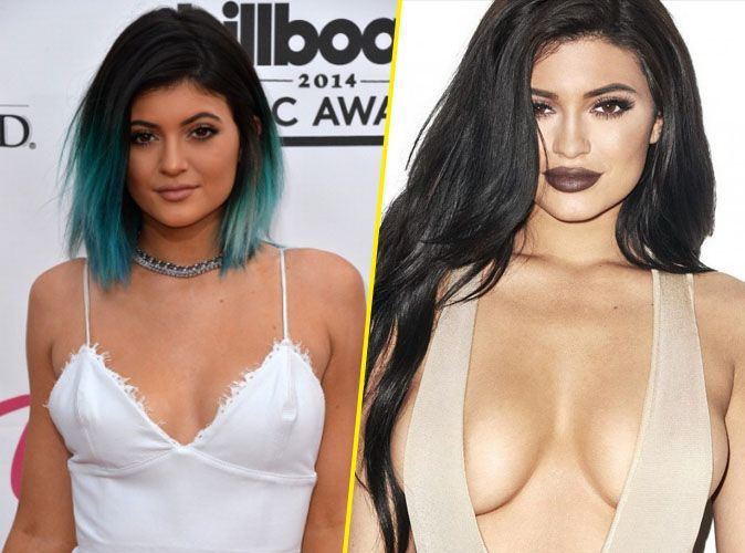 Kylie Jenner avant /apres : chirurgie des seins 