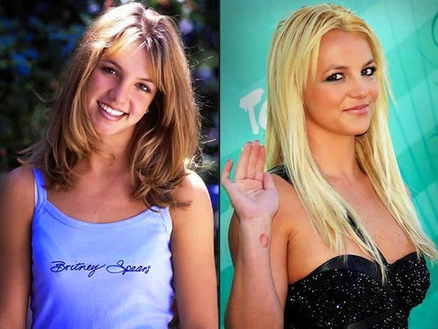 britney spears : avant /après une chirurgie des seins 