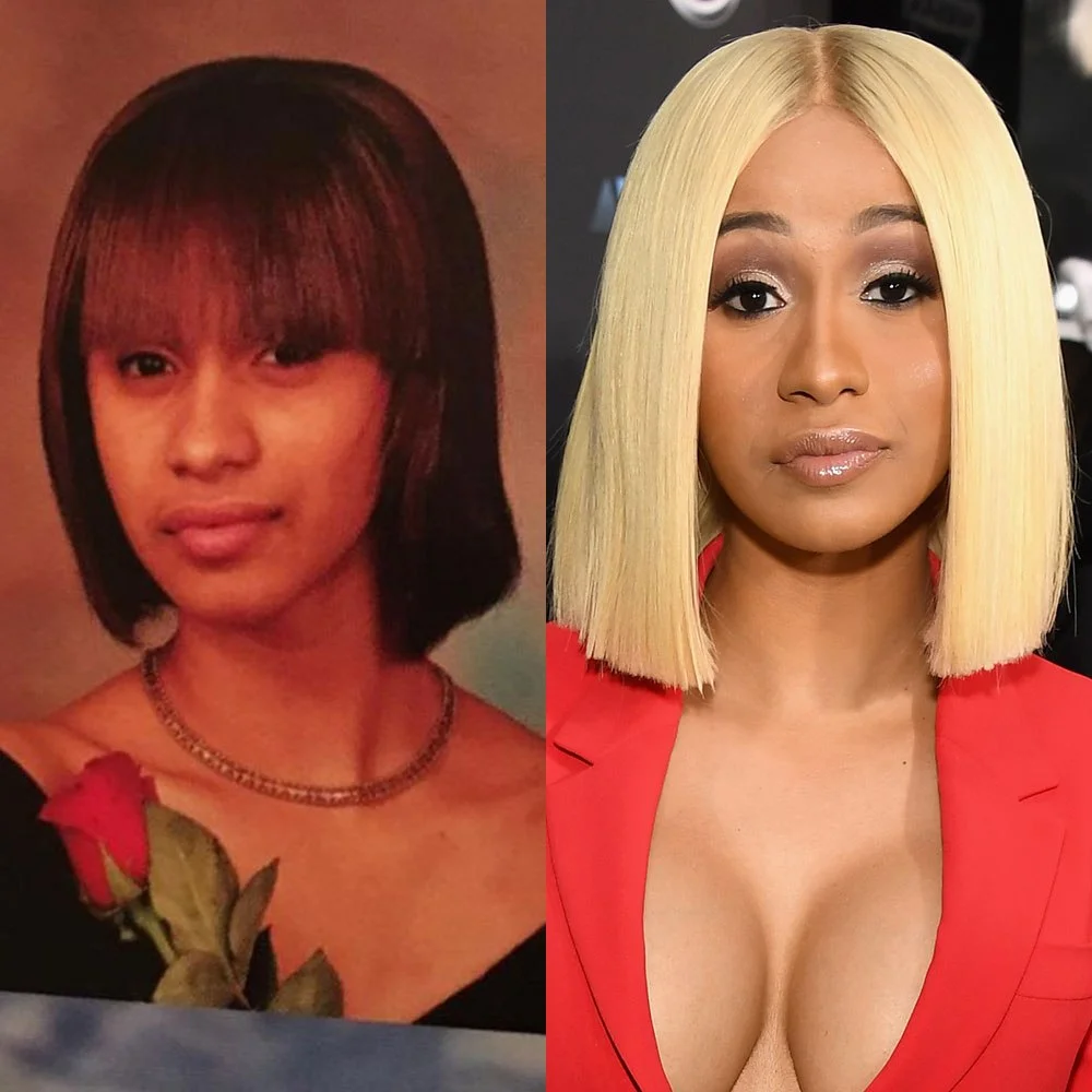 Cardi b : avant/après Augmentation Mammaire