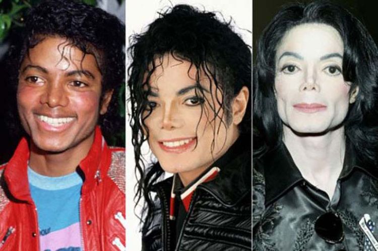 Michael Jackson avant/après 