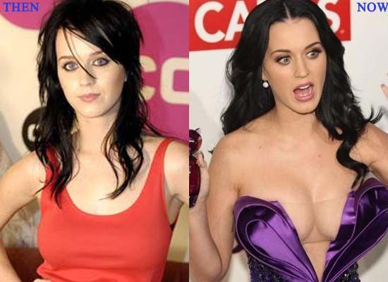 Katy Perry avant/après la chirurgie esthétique 