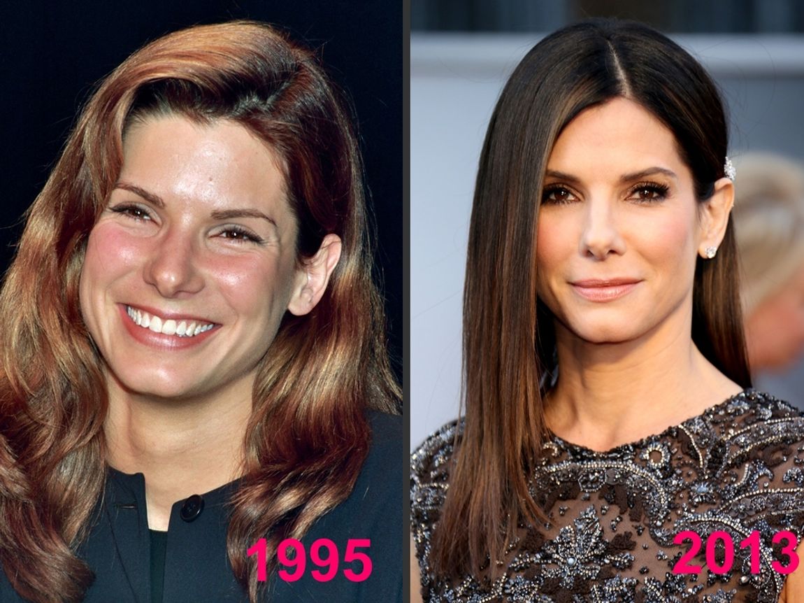 Sandra Bullock et la chirurgie esthétique : Son avant/après en photos 