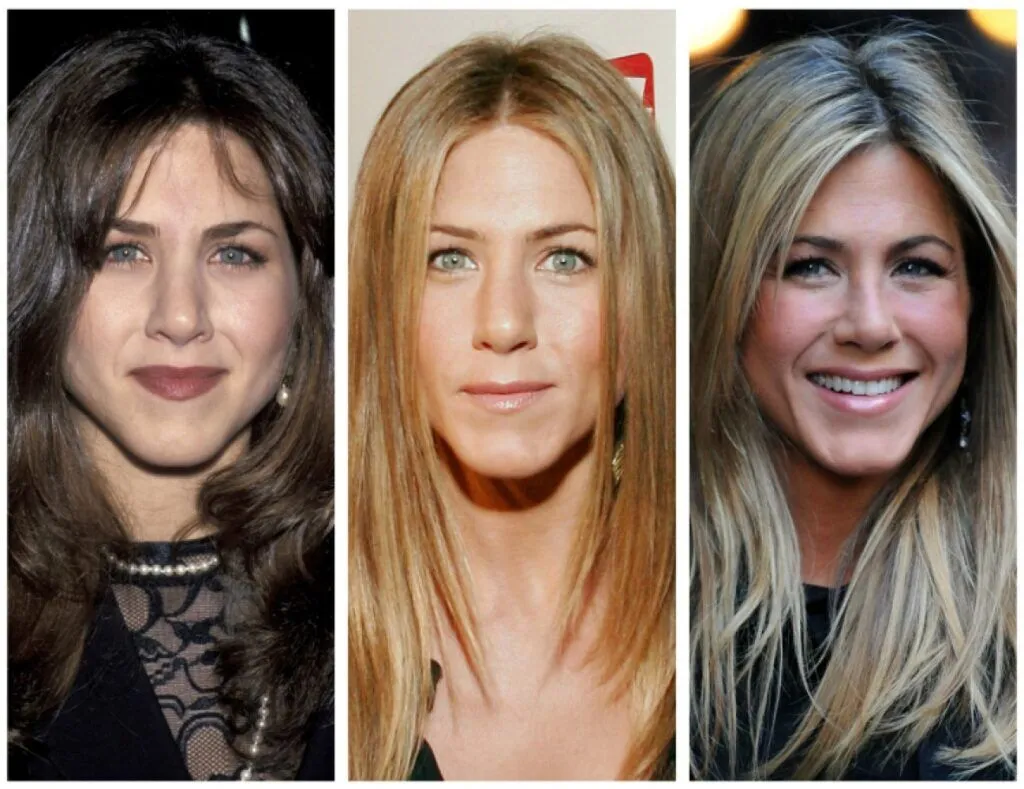 La transformation physique de Jennifer Aniston par la chirurgie esthétique