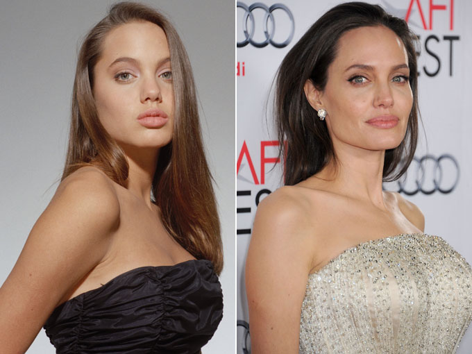 Angelina Jolie avant /après 
