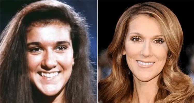 Céline Dion avant apres