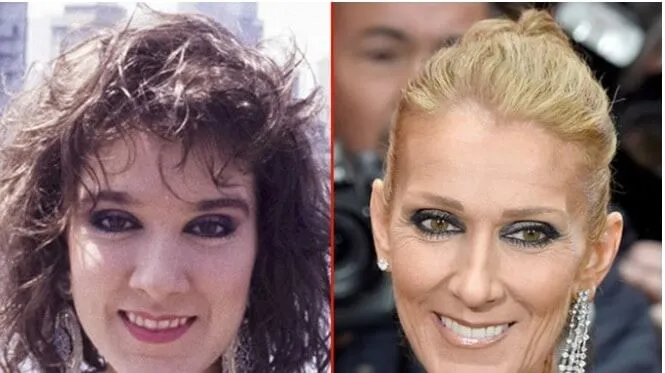 Céline Dion avant après