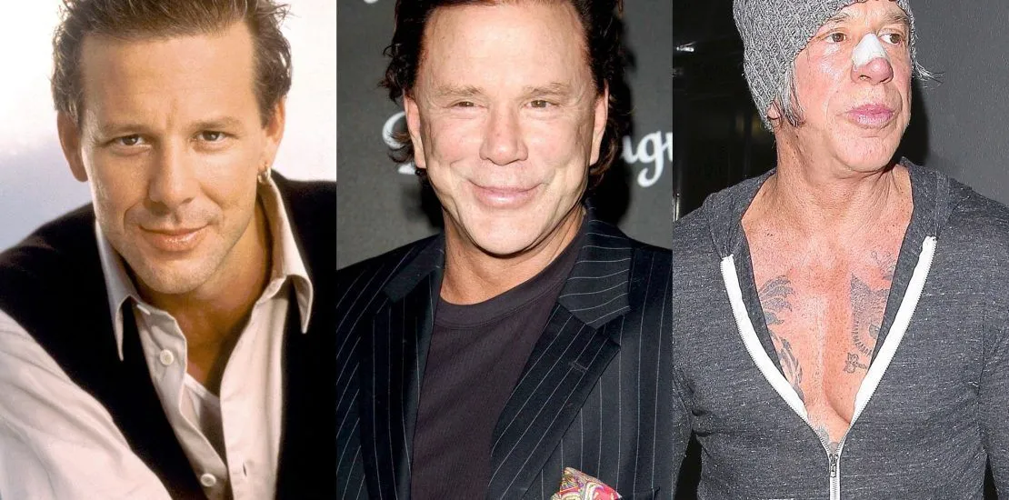 Mickey Rourke