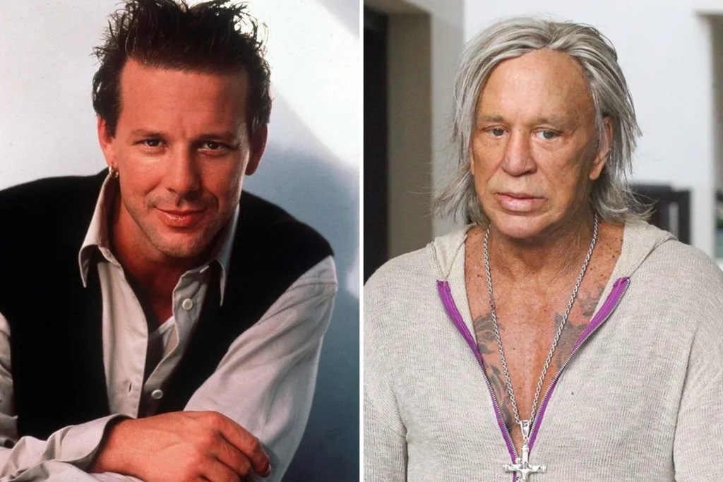 Mickey Rourke / Photo avant/Après chirurgie esthétique