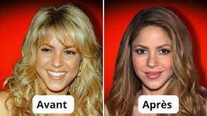 Shakira chirurgie esthétique : révélations et vérités