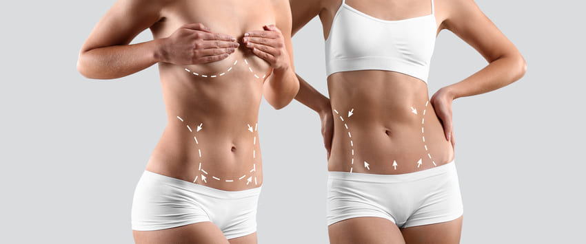 Quel est le prix d’une abdominoplastie ?