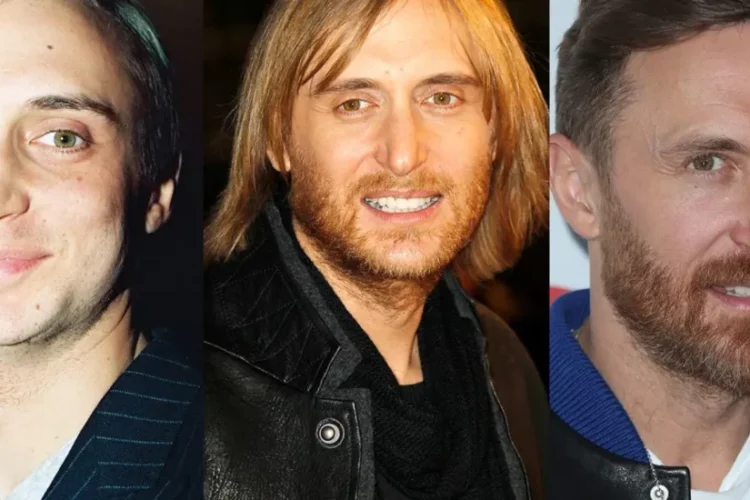 david guetta chirurgie esthetique