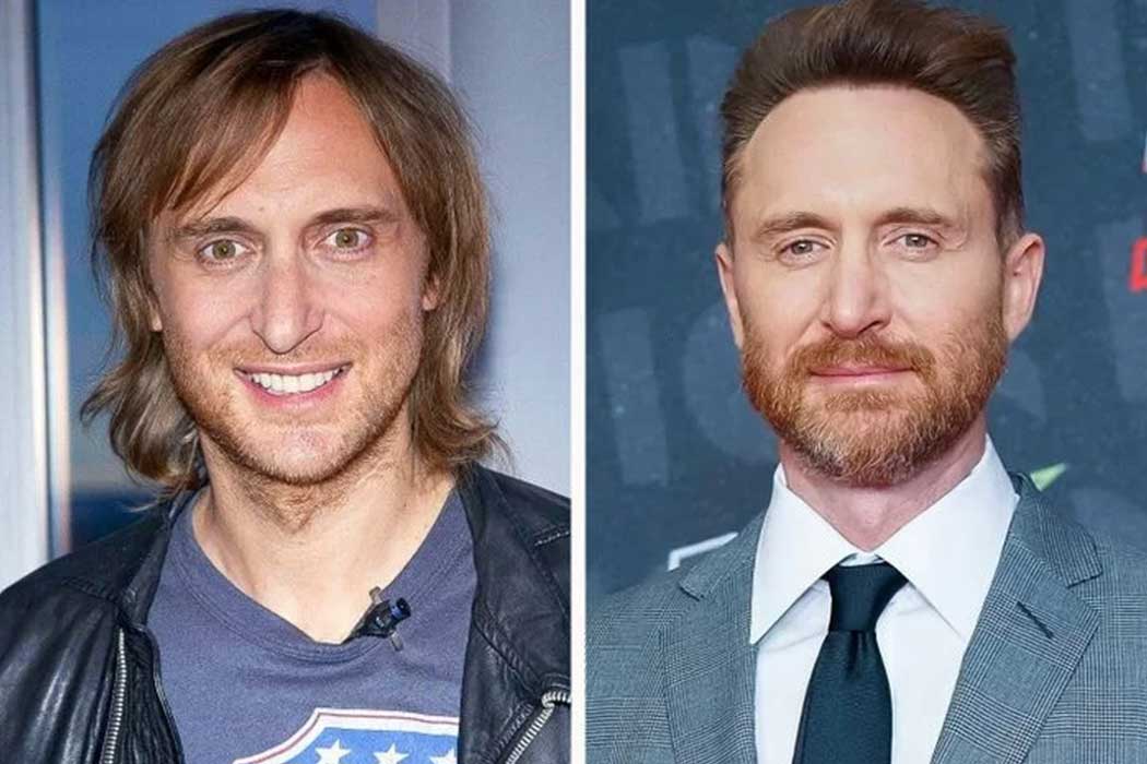 david guetta chirurgie esthetique