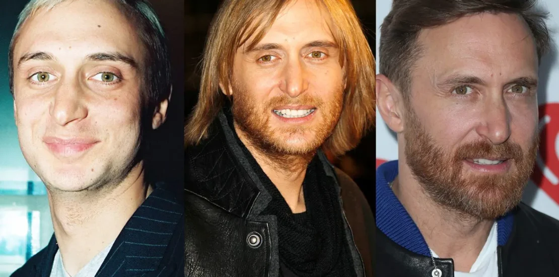 david guetta chirurgie esthetique