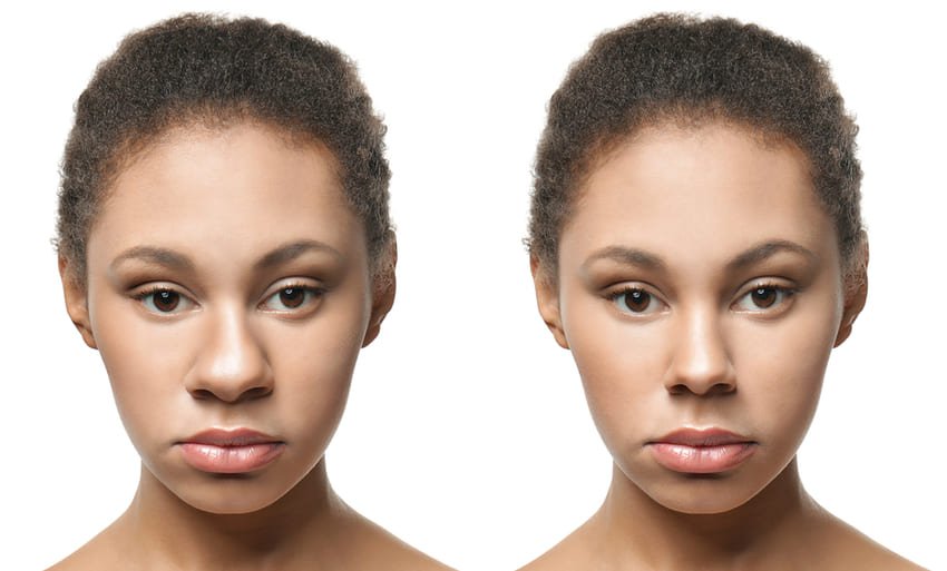 prix rhinoplastie ethnique Tunisie pas cher 