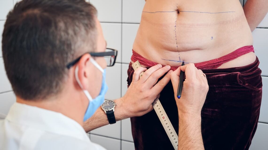 douleur après une abdominoplastie