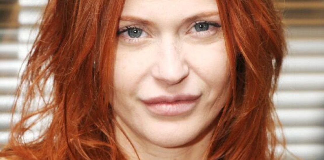 Axelle Red et la chirurgie esthétique